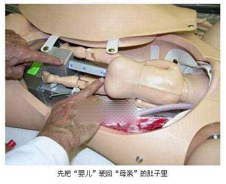 妇产科男医师为你演示模型分娩过程（图）